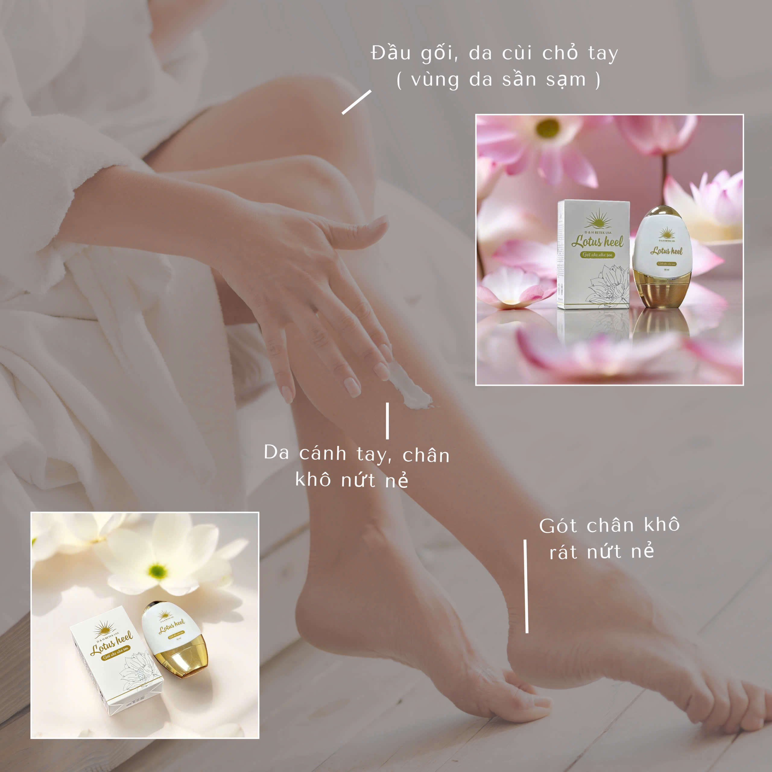 GÓT SEN LOTUS HEEL - Ảnh 5